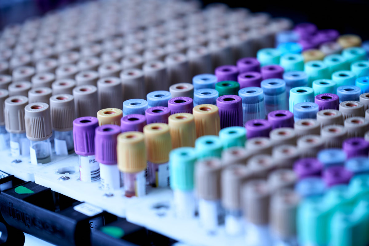 Colorful test tubes on a rack in a laboratory setting